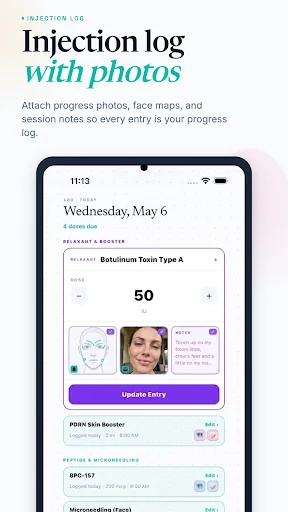 Injection log entry interface for botox dose amounts with photo upload capability and before-after face mapping